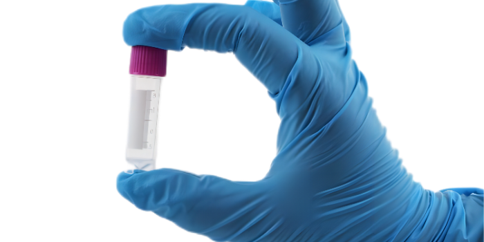 冷凍管“不適用于液氮液相”是什么意思？