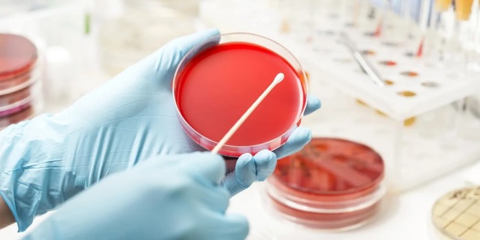 探索微觀世界的視窗——細(xì)胞培養(yǎng)皿