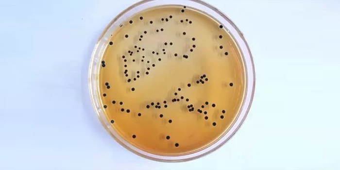 培養(yǎng)皿染菌問題的分析