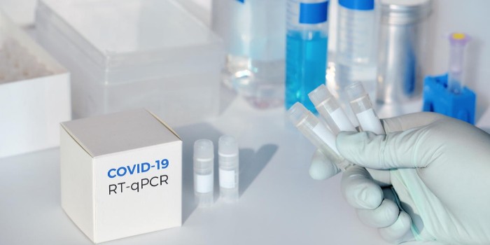 運(yùn)行 RT-qPCR 實(shí)驗(yàn)時(shí)的主要注意事項(xiàng)