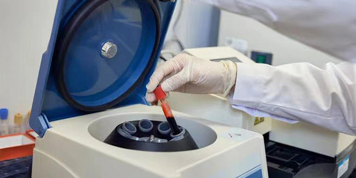 實(shí)驗(yàn)室使用的離心機(jī)類型及其用途